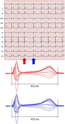 Sex and Rate Change Differences in QT/RR Hysteresis in Healthy Subjects